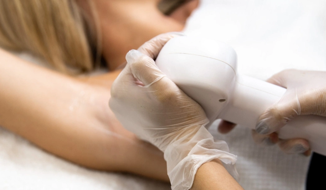 Is Laser Hair Removal Permanent?