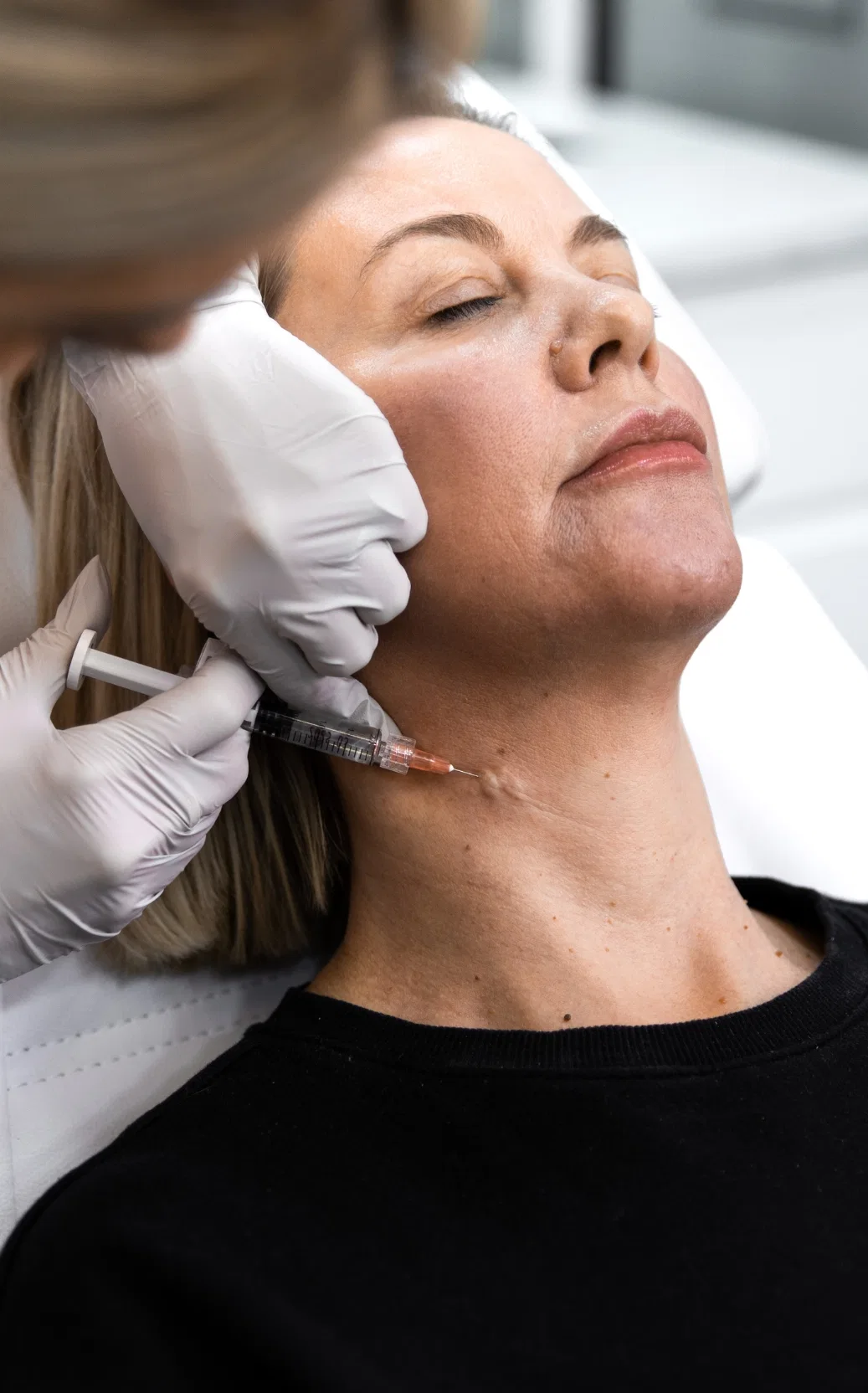 sla medical performing profhilo