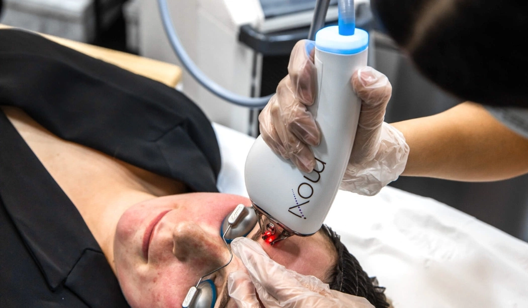 Sciton Moxi: The Best Way to Rejuvenate Your Skin By SarahLouise