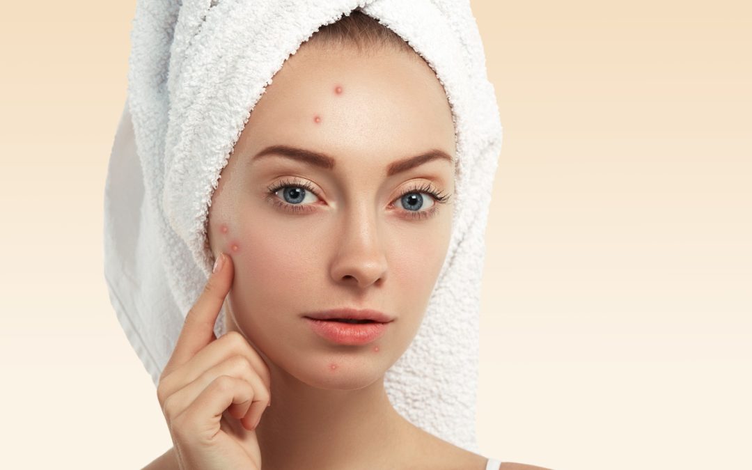 COMPREHENSIVE GUIDE TO EFFECTIVE ACNE TREATMENT CLEAR SKIN SOLUTIONS