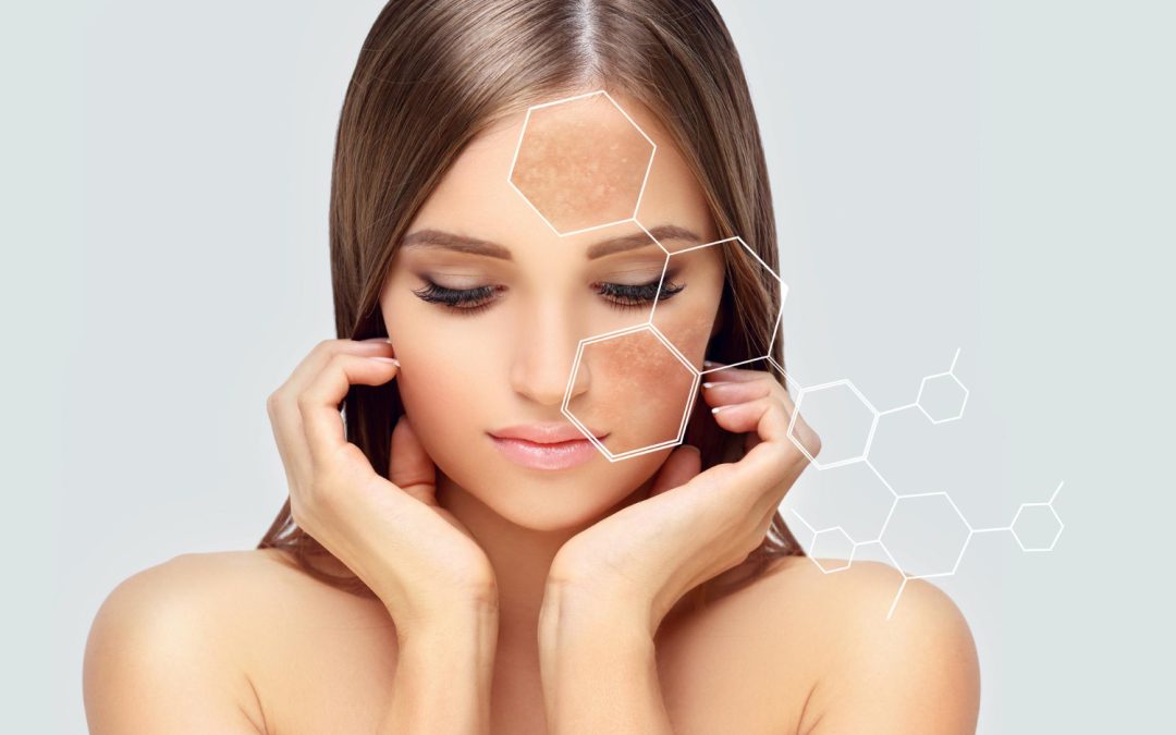 Expert Tips To Maximise The Results Of Your Skin Pigmentation Treatment