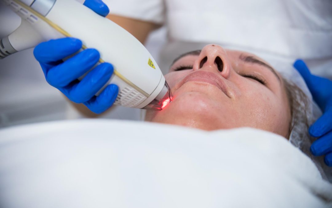 A GUIDE TO ACNE LASER TREATMENT