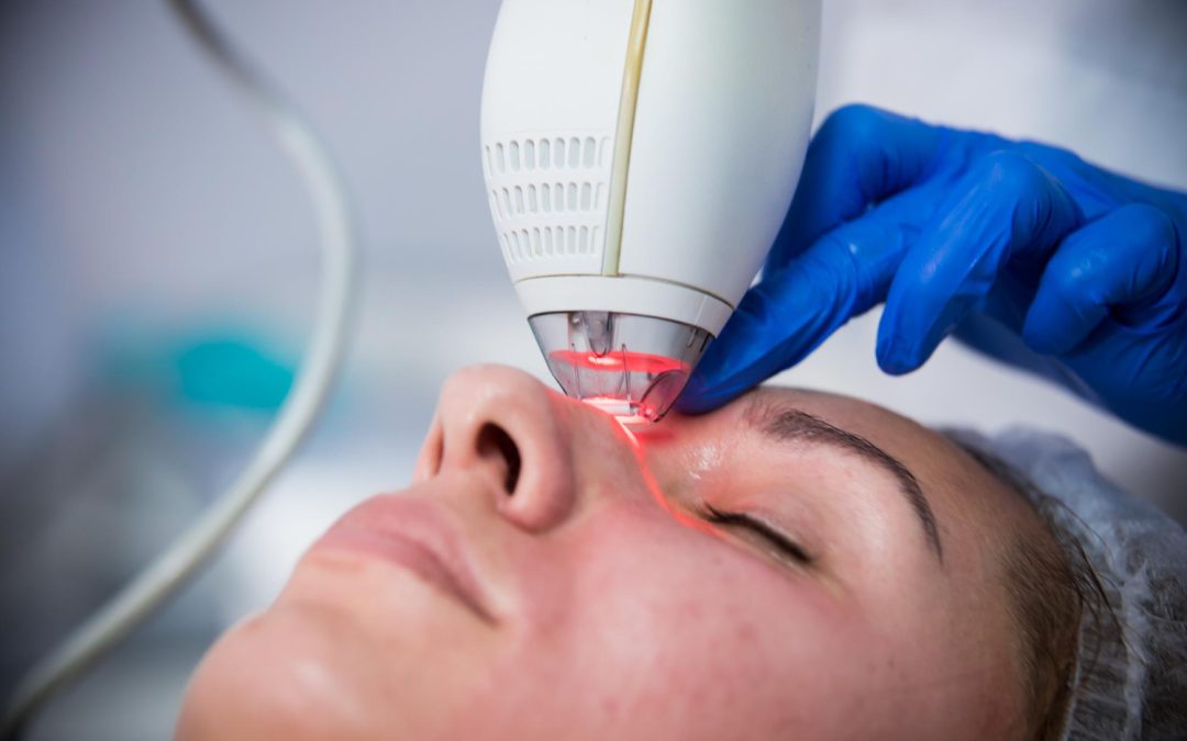 ACNE EXTRACTION RECOVERY TOP AFTERCARE TIPS TO STAY PIMPLE-FREE