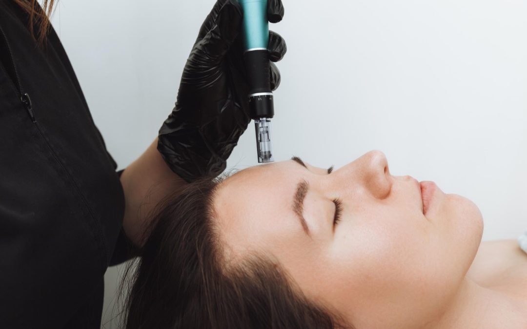 Microneedling Aftercare Your Complete Day-by-day Recovery Guide