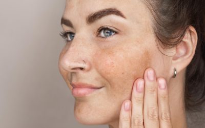 Understanding Rosacea Treatment A Complete Guide 2026