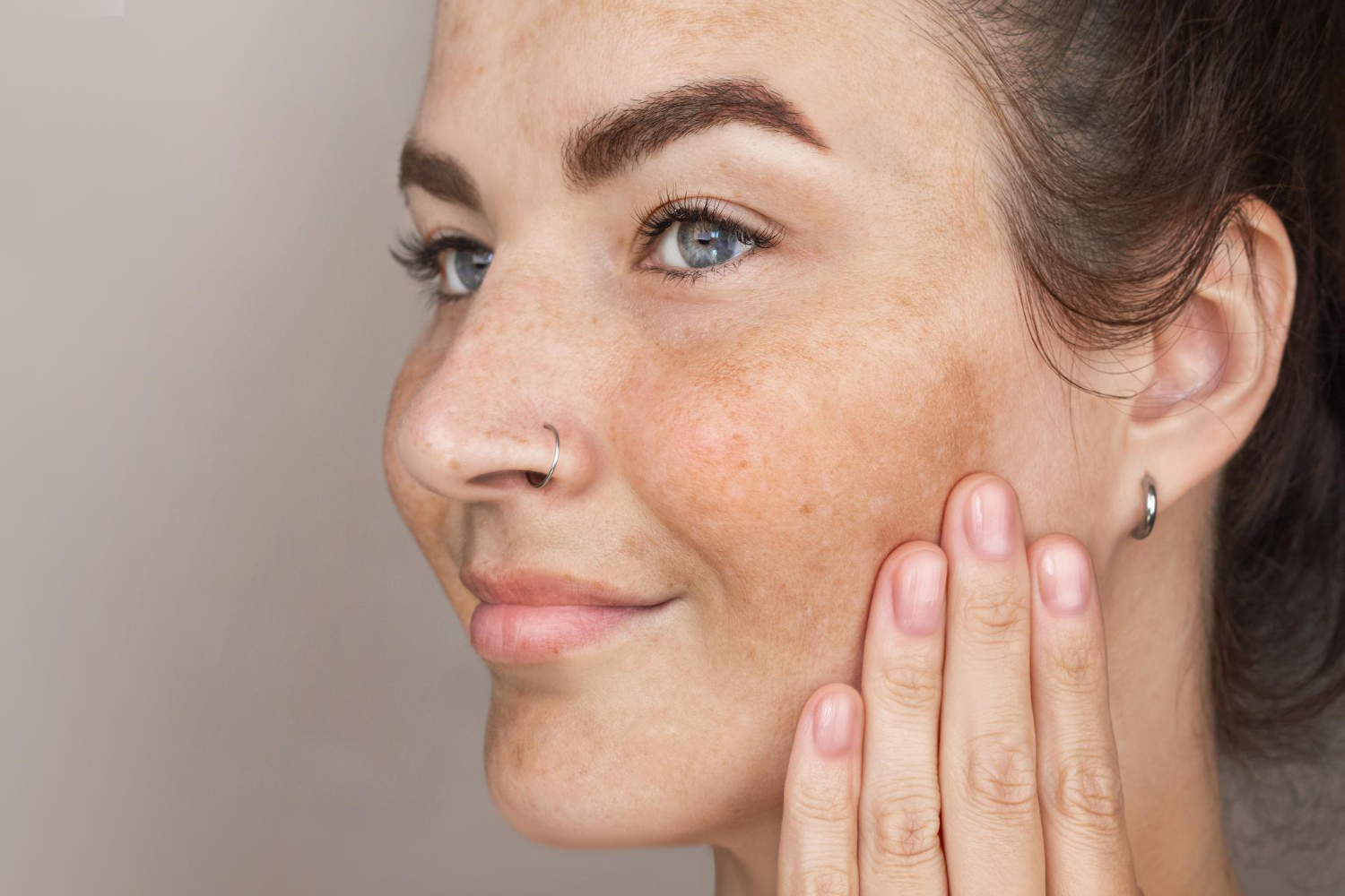 Understanding Rosacea Treatment A Complete Guide 2026
