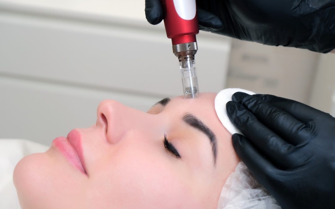 Why Growth Factors Take Microneedling In Manchester To The Next Level